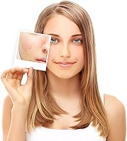 Babyface 30% Salicylic Acid Chemical Peel 1.2oz — image 5