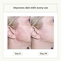 Cistto Natural Cleansing Oil 2mL x 40 Capsules — image 4