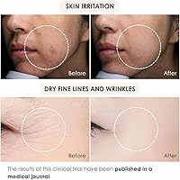 Fleuri Clear Gel Cleanse Exfoliating Gel Cleanser 5.1oz — image 4