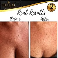 SILCIOR 2 Pack Silicone Chest Wrinkle Pads — image 3