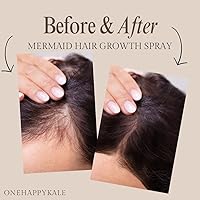 Onehappykale Mermaid Hair Growth & Restoration Spray – 4oz — image 4