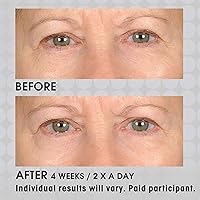 NASSIF MD Under Eye Smoother Firming Cream 0.5oz — image 7