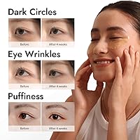 MIZON Under Eye Patches for Puffy Eyes & Dark Circles, 60 Pcs — image 2