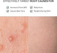 Y'OUR Acne Clearing Body Wash 10.1oz — image 5