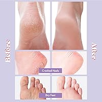 Toi:L Extra Silky Foot Mask 5 Pairs — image 2