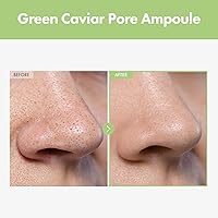 TOSOWOONG Green Caviar Pore Ampoule 33ml — image 2