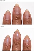 Dermelect Instant Nail Makeover Trio - 3 pc Set — image 8