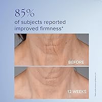 iS CLINICAL Neckperfect Complex Neck Firming Cream 50mL — image 3