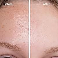 Hollywoodskin Face Lift In A Bottle 2.5% Retinol Serum 30ml — image 3