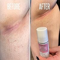 Divine Derriere Intimate Skin Lightening Gel for Body and Bikini Area — image 7