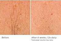 NassifMD Deco-Lift Neck Firming Complex Serum 5.29oz — image 6