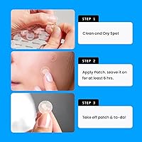 Avarelle Pimple Patches for Face, 200 Count — image 3