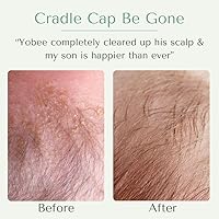 Yobee Ultra Gentle Soothing Scalp Mask for Babies 4oz — image 2