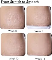 Anveya Stretch Marks Expert Serum Cream — image 5