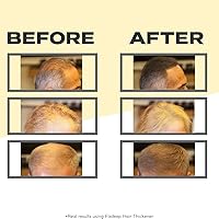 Fixdeep Hair Fibers for Thinning Hair Black 14g — image 3