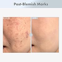 TOSOWOONG Niacinamide 15% Face Serum 30ml — image 3