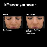 PCA SKIN Intensive Clarity Treatment 0.5% Retinol & 2% Salicylic Acid Face Serum 1oz — image 4