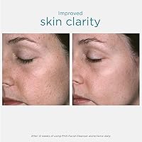 NEOSTRATA PHA Facial Cleanser, 6.8 Fl Oz — image 3