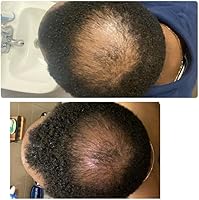 Kreyol Essence Scalp Care Conditioner 8oz — image 5