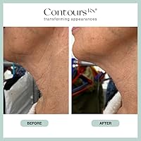 Contours Rx Neck Rescue Instant Correcting Strips, 30 Count — image 7