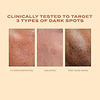 Murad Rapid Dark Spot Correcting Serum 1 Fl Oz — image 6