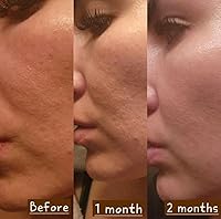 Derma Detox Rejuvenating Facial Night Cream with Retinol, Tepezcohuite & Niacinamide 1oz — image 4