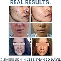 Clearogen Sensitive Skin Sulfur Acne Lotion 1.8 FL Oz — image 3