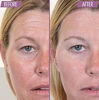 Athena 7 Minute Lift Organic Lifting & Firming Serum — image 10