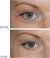 Dermelect Revitalite Eyelid & Dark Circle Corrector 0.5oz — image 8