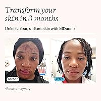 MDacne 3 Step Retinol Acne Kit — image 3