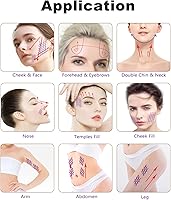 Elves PDO Threads Lift for Face and Body, 20pcs (26G60mm) — image 8