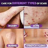 Cicatricure Advanced Scar Gel 2 oz — image 4