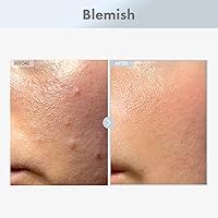 TOSOWOONG Niacinamide 15% Face Serum 30ml — image 2