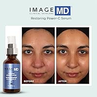 IMAGE Skincare MD Restoring Power-C Serum 20% Vitamin C — image 7