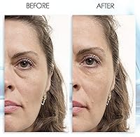 Aqua Mineral Puffy Eye Gel – 1 oz — image 2