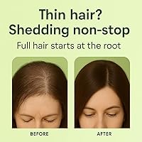 LUSTEL Rosemary Strengthening Volumizing Shampoo and Conditioner Set - 16 Fl Oz Each — image 6