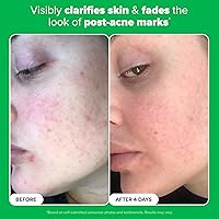 Paula's Choice BOOST 10% Azelaic Acid Booster — image 5