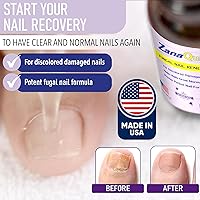ZanaQuick 2 Step Toenail Fungus Treatment Kit — image 2