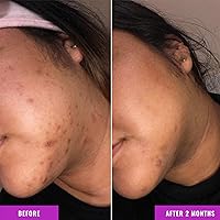 Good Molecules Discoloration Correcting Serum 1.76oz — image 4