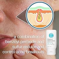 Control Corrective Clear Med 5% Acne Treatment Lotion 2.5oz — image 3