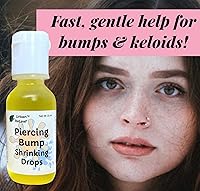 Urban ReLeaf Piercing Bump Shrinking Drops & Piercing Relief Solution — image 6