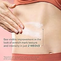 StriVectin SD Advanced™ Plus Intensive Moisturizer 118mL — image 11