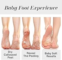 Baby Foot Original Foot Peel - 2 Treatments — image 7