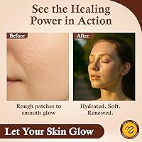 Sweet Bee Magic All In One Healing Organic Balm 12oz — image 7