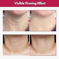 TOSOWOONG Collagen Necktox Cream 50ml — image 3