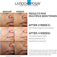 La Roche-Posay Glycolic Acid Serum with Kojic Acid and Vitamin B5 1.06oz — image 2