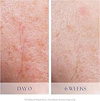 iS CLINICAL Active Serum 2.72oz — image 5