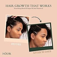 Noor Hair Growth Serum — image 3