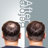 The Mossi London Hair Growth Shampoo 6.7oz — image 3