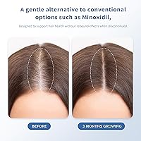 QGGQ Hair Growth Serum Roll-On 30ml — image 2